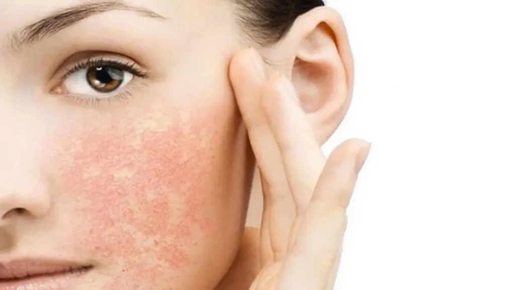 تصویری که نشان دهنده پوست حساس است