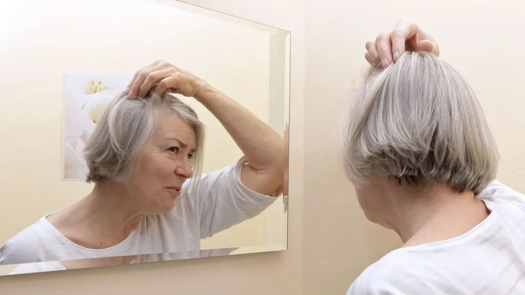 افزایش سن از دیگر دلایل ریزش مو 