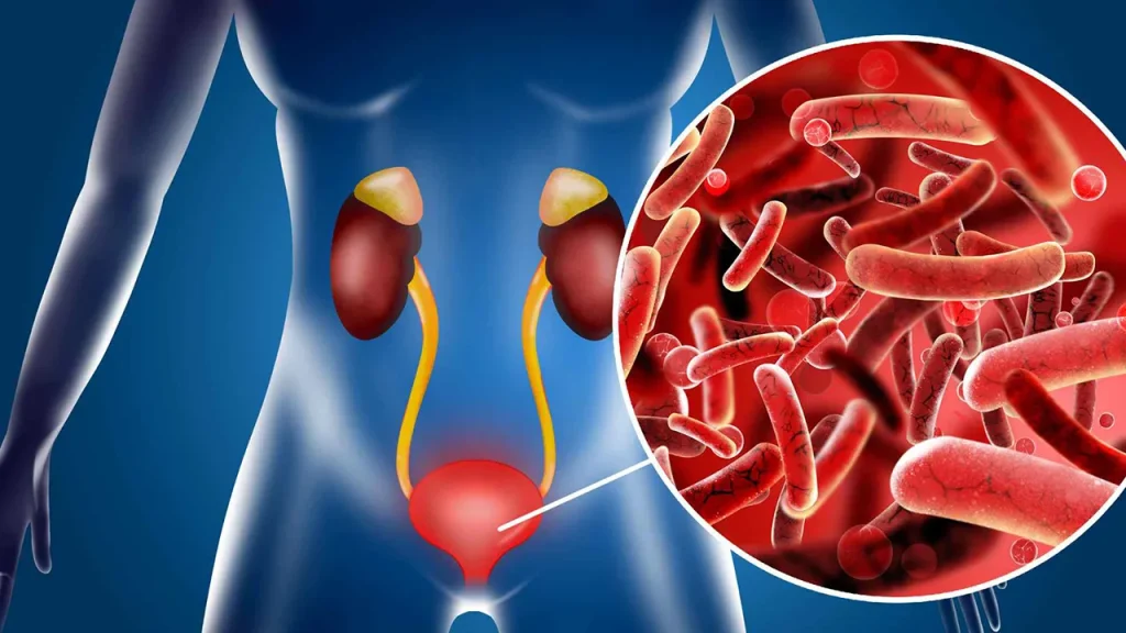 افزایش احتمال عفونت