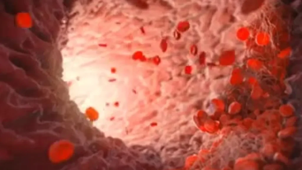 کمبود جریان خون