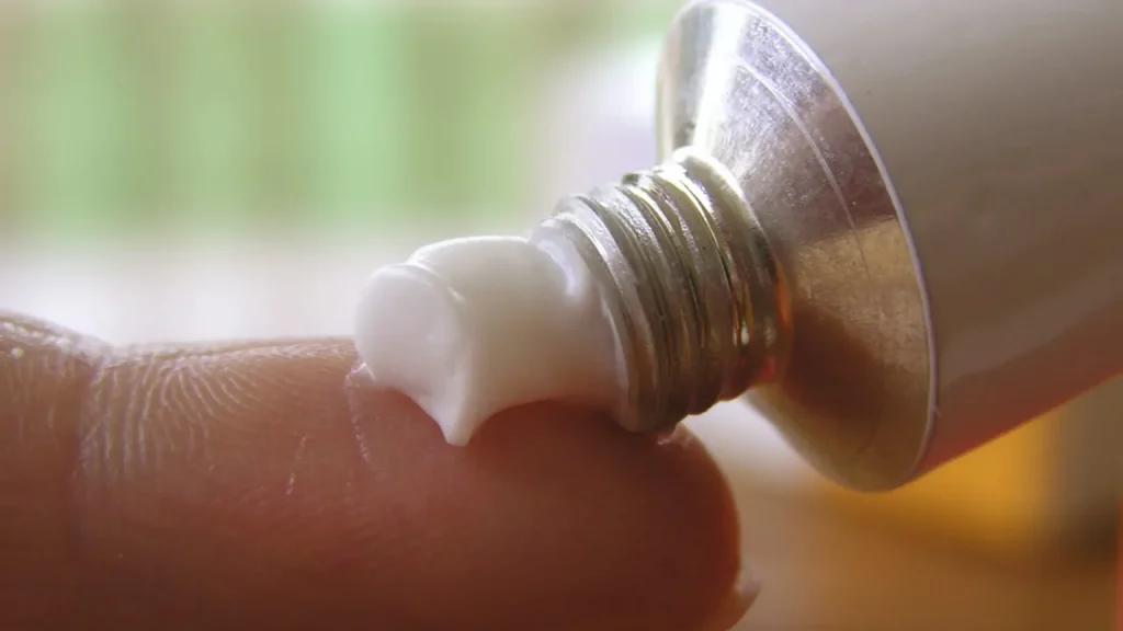 تاثیر استروئید در درمان اگزما