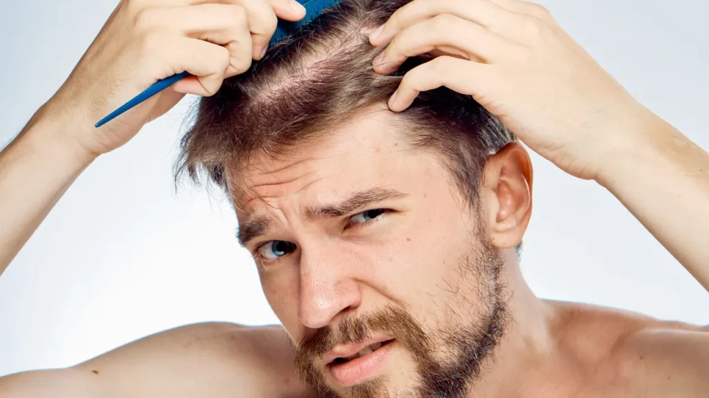 مراقبت مو مردانه