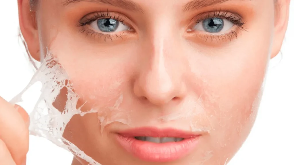 لایه برداری شیمیایی