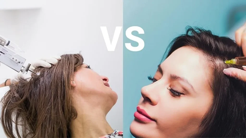 مقایسه مزوتراپی و پی ار پی