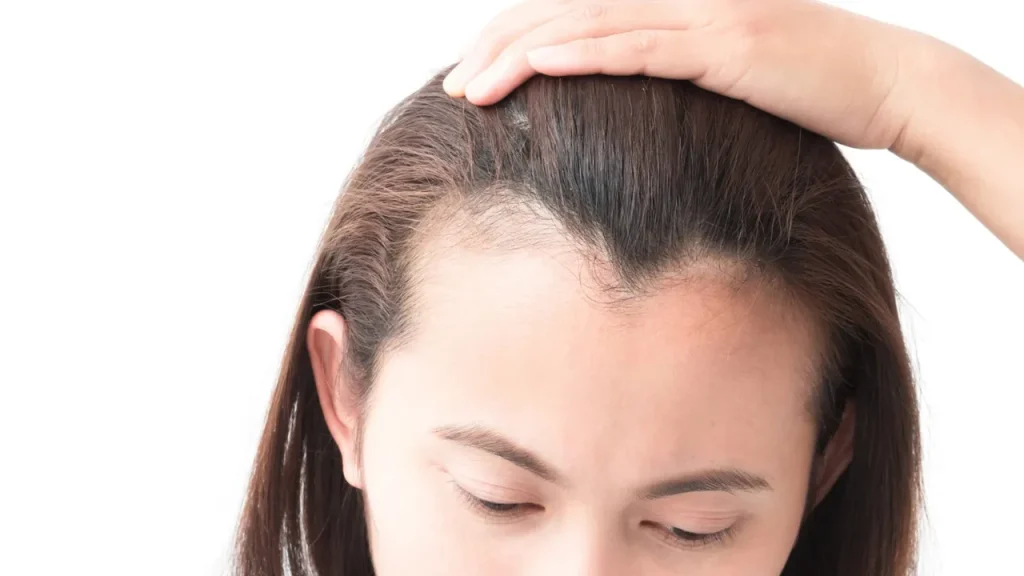 جلوگیری از ریزش مو از دیگر خواص گیاه مورد