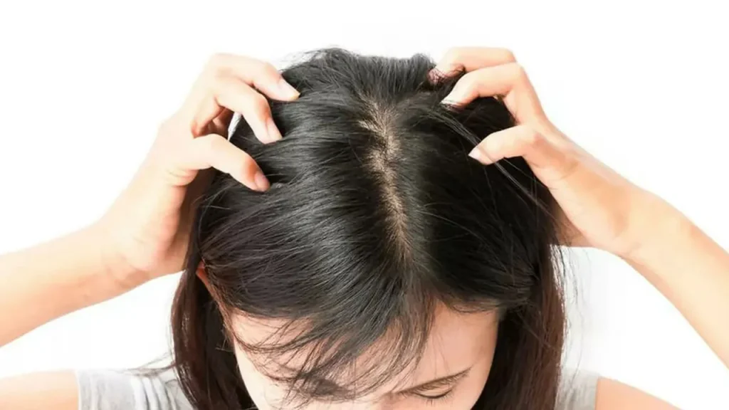 کاهش چربی و شوره سر با استفاده از کافئین