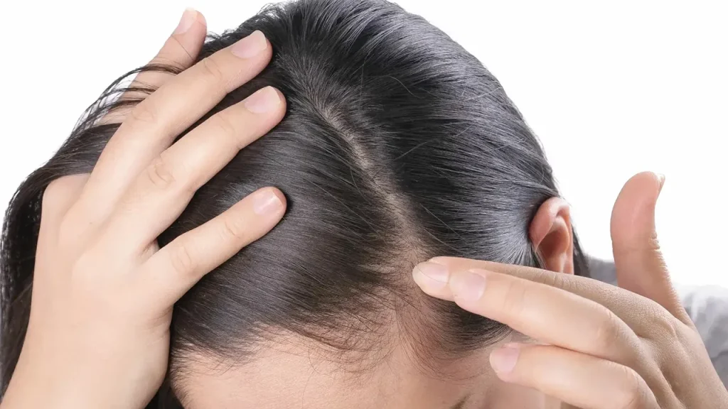 مقابله با خشکی پوست سطر با استفاده از گوجی بری