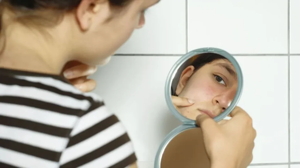 دوران بلوغ و تاثیرات آن بر روی پوست