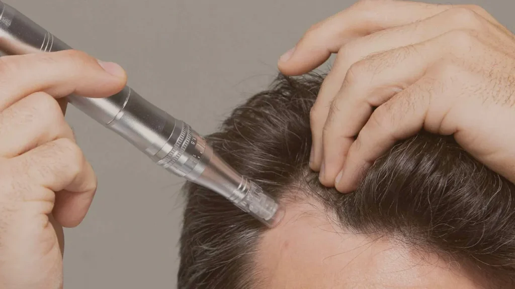 مقایسه میکرو اسکالپ با پودر تاپیک
