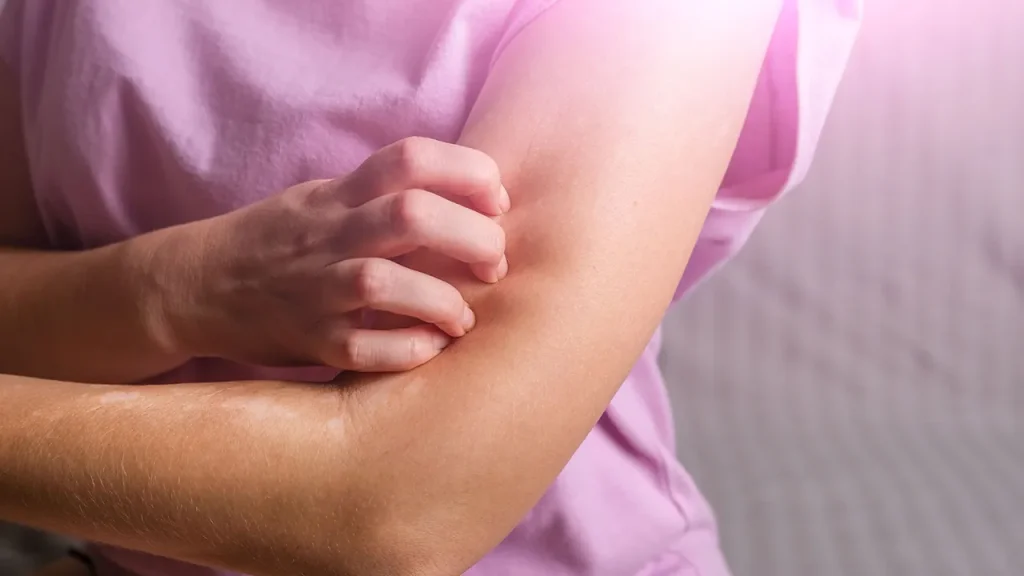 بابونه و کاهش حساسیت