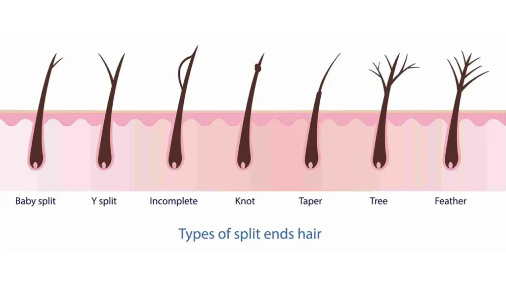 موخوره ناقص