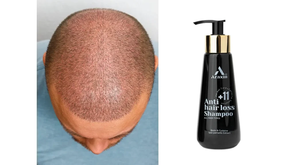 استفاده از محصولات مراقبتی آراکسین قبل از اسکالپ