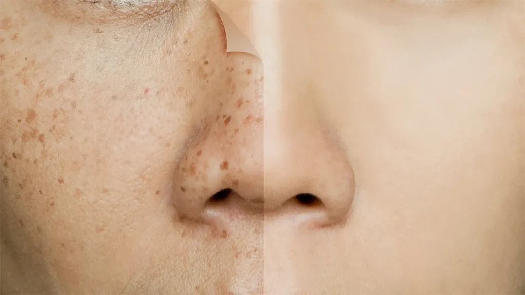 لک های صورت