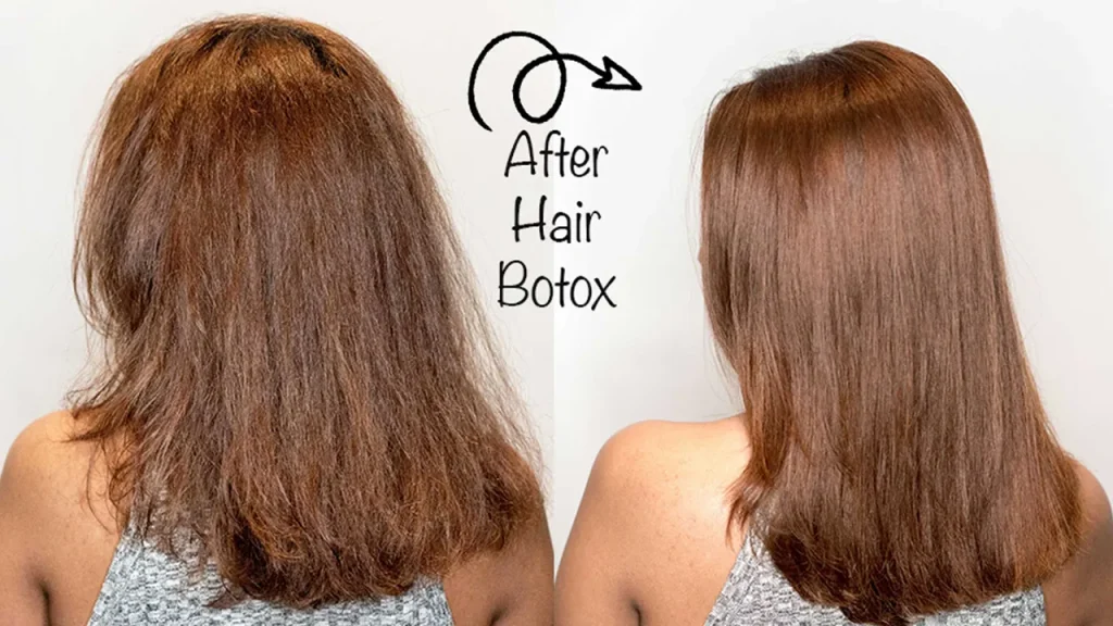 بوتاکس مو سر