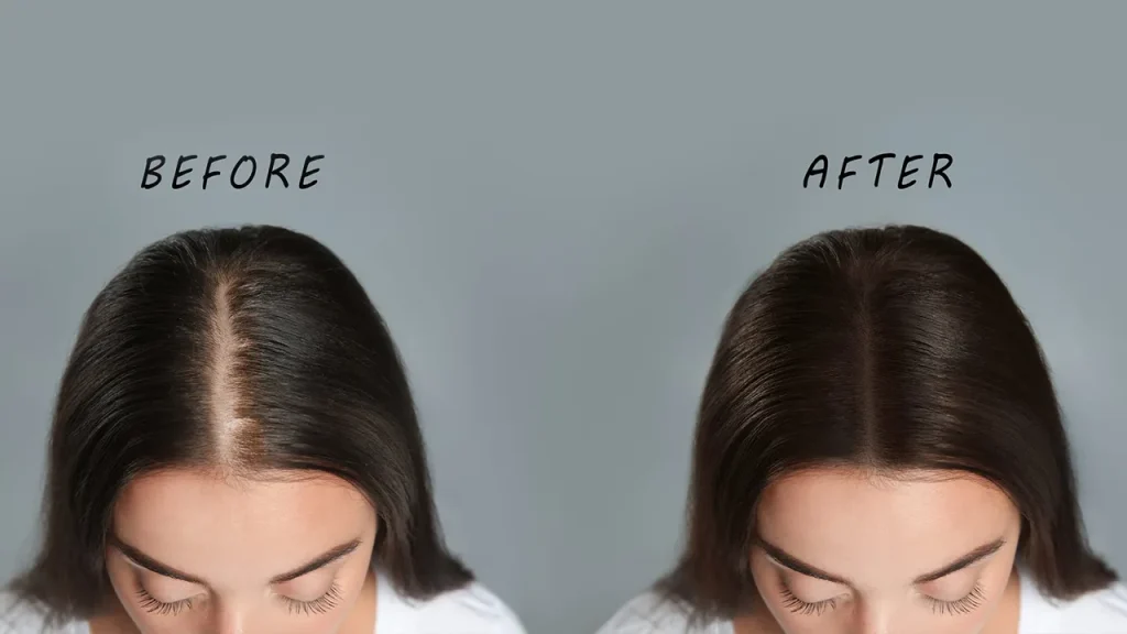 تقویت رشد مو