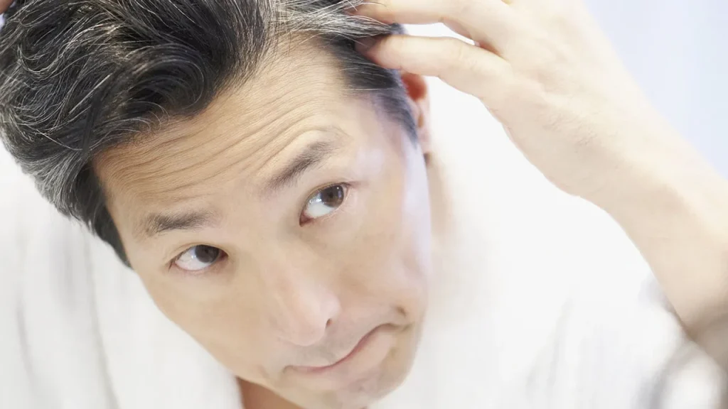 عوامل موثر در سفید شدن مو