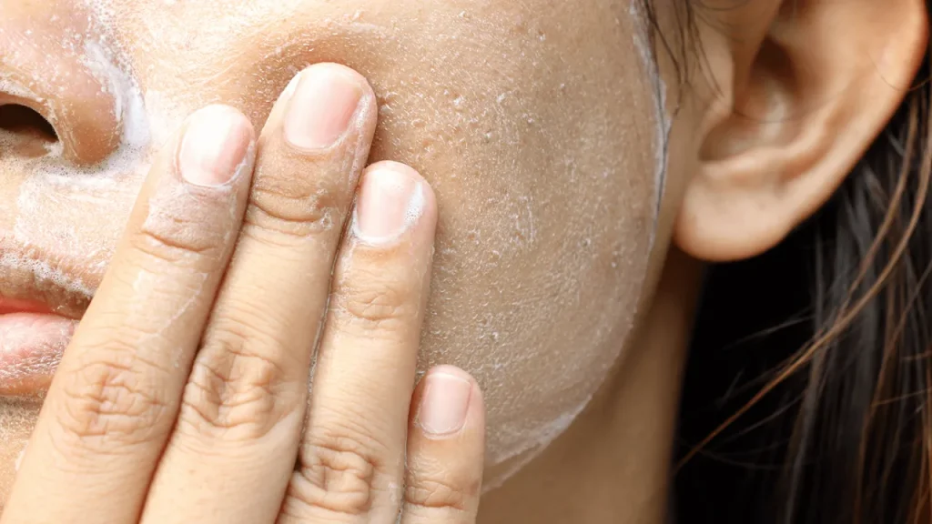 پیامدهای ناشی از برداشت