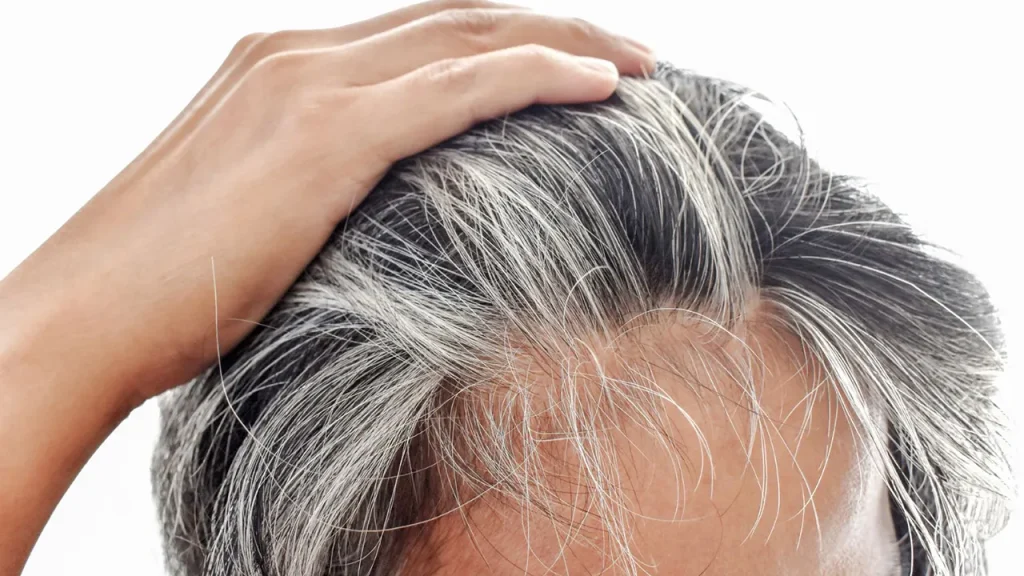 ژنتیک، بازیگر اصلی سفیدی مو