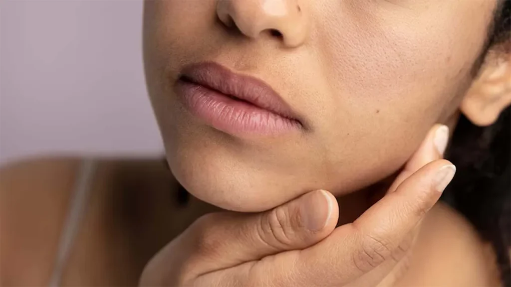 کدر شدن پوست